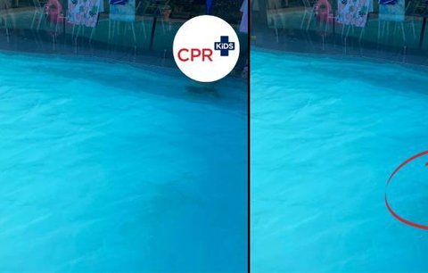 Šokující foto zdravotních sester: V tom bazénu je dítě!