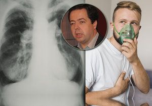 S plicní hypertenzí se v Česku léčí přibližně 1 000 pacientů, každý rok jich přibližně 150–200 přibude.