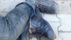 Z nohy bezdomovce odpadávali červi.
