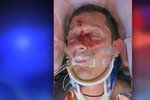 Na Nymbursku srazil zfetovaný řidič cyklistu: Zraněného muže nikdo nezná, policie prosí o pomoc