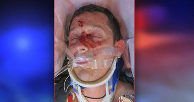 Na Nymbursku srazil zfetovaný řidič cyklistu: Zraněného muže nikdo nezná, policie prosí o pomoc.