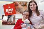 Blesk Podcast: Kadlecovi si adoptovali syna s ichtyózou. Martínka musí několikrát denně mazat, aby nebyl »sušenka«