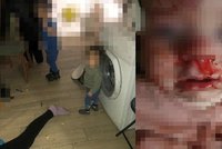 Drama na Slovensku: Vyjednávání s malým chlapcem a zraněná osmiměsíční holčička!