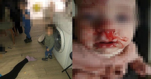 Drama na Slovensku: Vyjednávání s malým chlapcem a zraněná osmiměsíční holčička!