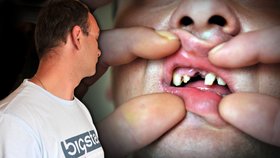 Opilý zubař vytrhl nebožákovi zdravý zub: Měl 3 promile alkoholu v krvi!