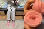 Japonská babička si spletla umělé vaginy s ponožkami.