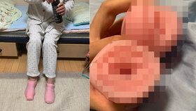 Babička si spletla umělé vaginy vnuka s ponožkami: Natáhla si je na nohy a nemohla je dostat dolů