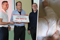 Děsivá statistika v Česku: 9 tisíc popálených dětí za rok!