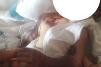 Inkubátor upekl zaživa nedonošené miminko. Doktoři použili špatné žárovky