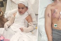 Chlapce málem zabil řetízek na krku: V noci dostal ránu ze zapojené nabíječky!