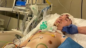 Tragická dovolená: Opilý mladík (22) spadl z vozítka a nyní nemůže mluvit