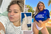 Slavná pornoherečka se bojí o kariéru: Naněkolikrát zlomená noha, operace a jizvy na těle