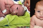 Kryštůfek se při porodu dusil, lékaři ho oživovali 36 minut.