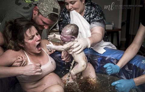 Čím dál odvážnější! Podívejte se na nejlepší porodní fotky roku 2019