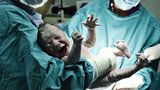 Žena začala předčasně rodit na záchodě. Díky všímavým lékařům dítě přežilo