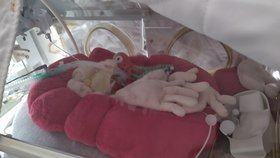 V Perinatologickém centru Fakultní nemocnice Brno na Obilním trhu dokážou lékaři se sestrami vypiplat i drobečky s porodní váhou menší než jeden kilogram.