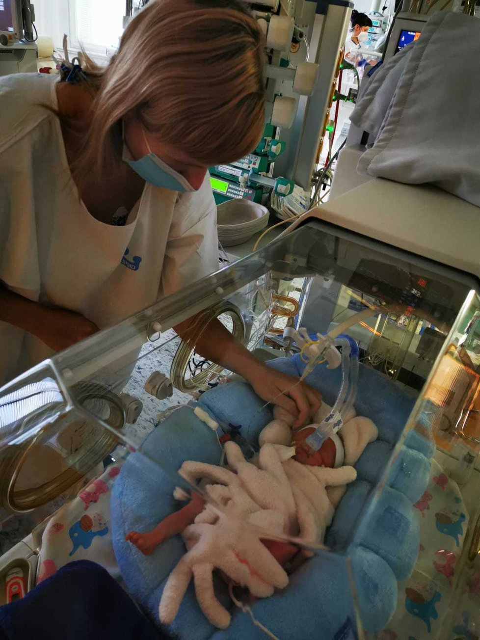 Teprve až se maličko zotavila po těžké, dlouhé a náročné operaci, mohla se jít Jana podívat na své vytoužené miminko.