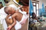 Porodnice v Africe či válkami sužovaných zemí nemají dost kapacit.