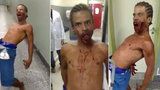 Muže s prostřeleným obličejem posedl ďábel! V nemocnici ohrožoval zdravotníky