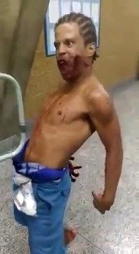 Muže v brazilské nemocnici posedl sám ďábel.