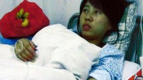 Mladá žena těsně po potratu leží v nemocnici