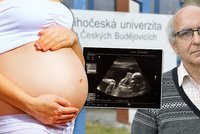 Expert na lékařskou etiku: Nikdo nemá právo rozhodovat o životě druhého!