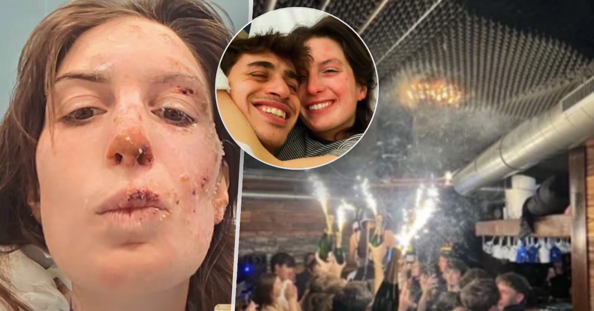 Crans-Montana: ¡Una italiana sobrevivió al infierno en un bar! Las llamas le quemaron la cara.