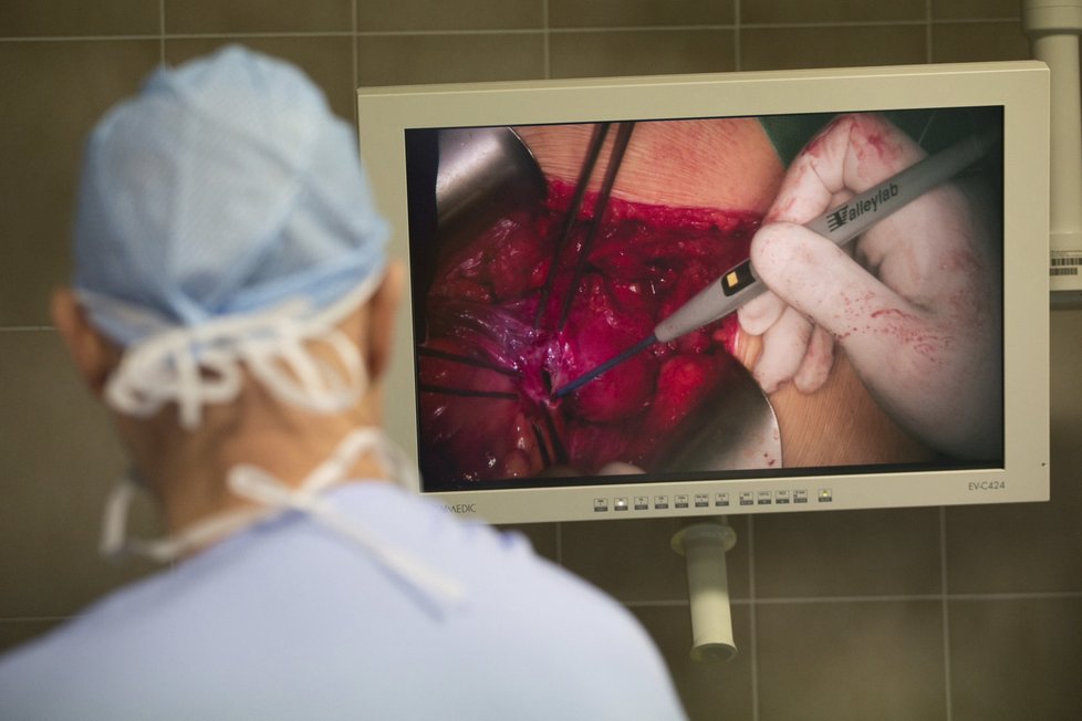 Unikátní operaci, provedli lékaři pražského IKEMU, při které provedli transplantaci dělohy