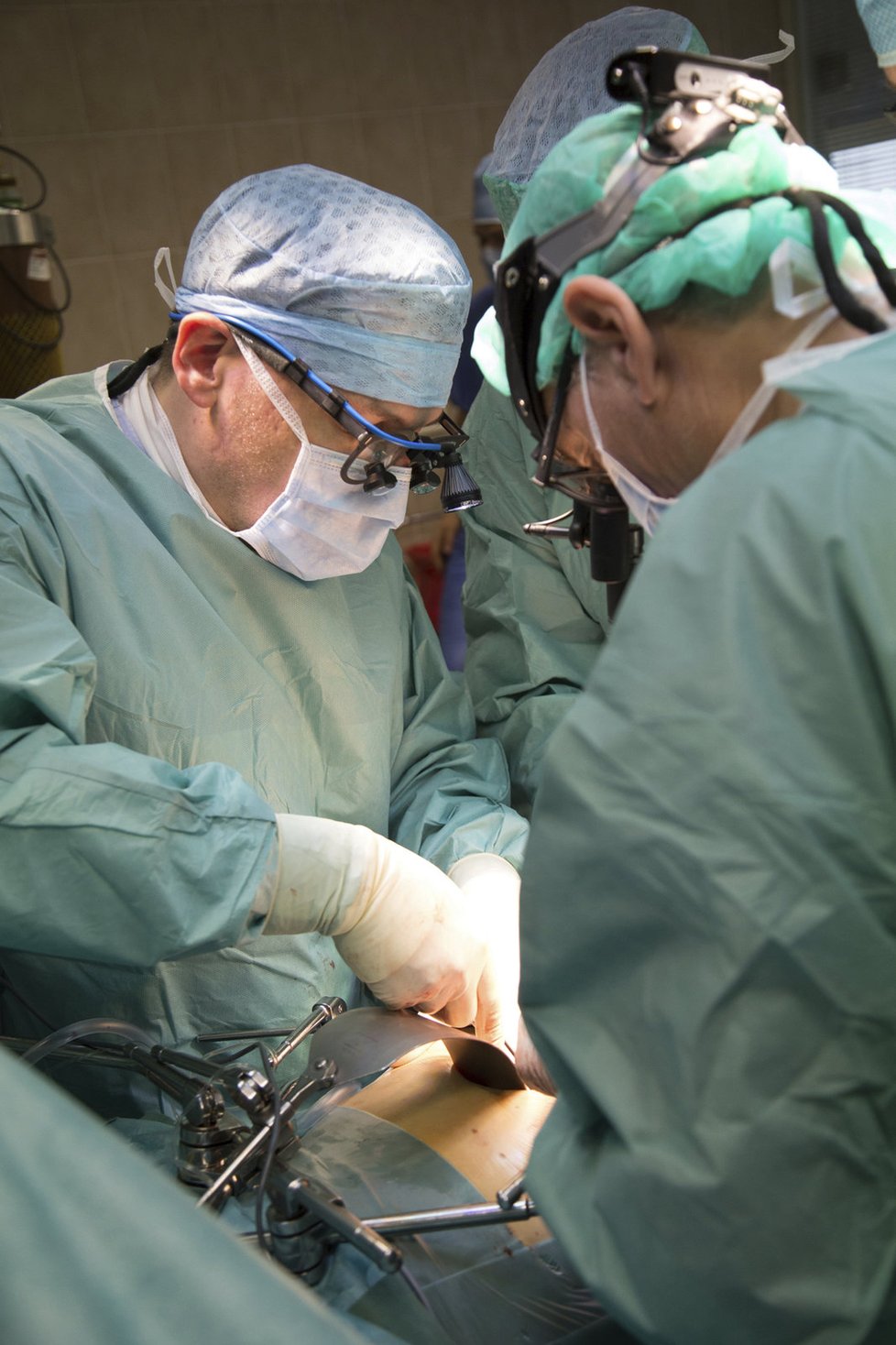 Unikátní zákrok provedli lékaři pražského IKEM, při kterém provedli transplantaci dělohy.