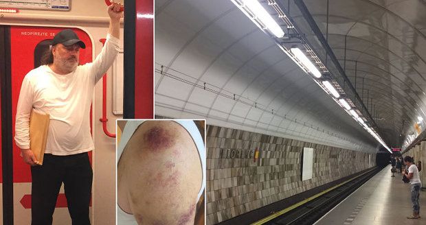 „Píchali mi injekce do zad.“ Jakl kvůli útoku v metru udeřil i na policii