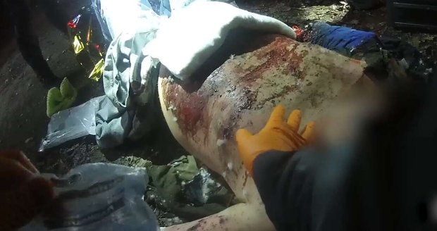 Muž při výbuchu petardy přišel na silvestra krátce po půlnoci o ruce.
