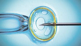 In vitro fertilizace čili oplodnění ve zkumavce předchází odebrání vajíček (matky či dárkyně), jež se pak spojí se spermiemi otce v živném roztoku (médiu). Po úspěšném oplodnění se vajíčka, popřípadě embrya vloží do dělohy, a pokud se alespoň jedno z nich zanoří, může začít těhotenství.