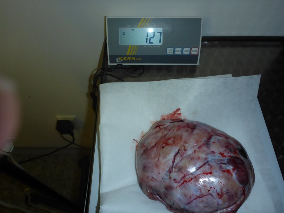 Veterináři zachránili život opuštěnému pejskovi. Z těla mu vyoperovali 1,27kilogramový tumor.