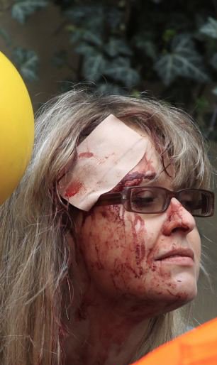 Ženu zranily trosky z exploze na hlavě