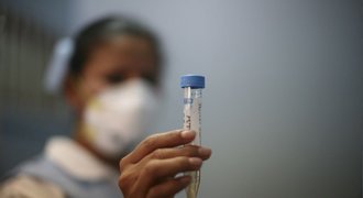 Očkujte se proti prasečí chřipce, vyzývá Vancouver