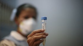 První oběť prasečí chřipky v ČR: Trvalo to osm měsíců