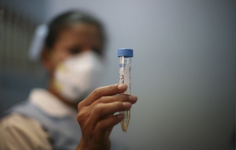 První oběť prasečí chřipky v ČR: Trvalo to osm měsíců