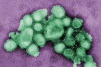 Kostarika má prvního mrtvého kvůli mexické chřipce