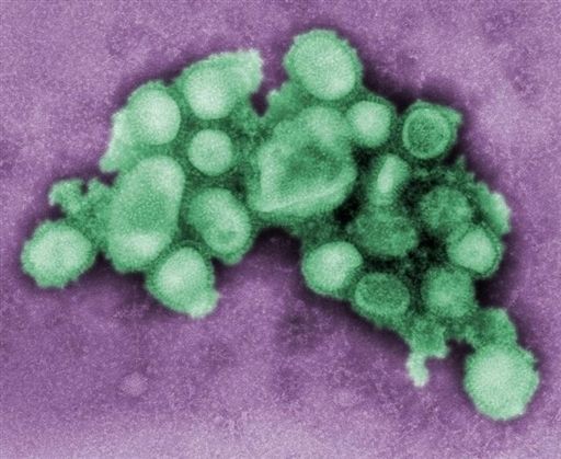 Virus prasečí chřipky