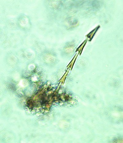 Objevený chlup larvy brouka rušníka obilného na mikroskopickém snímku naznačil přítomnost obilovin