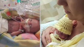 „Prosila jsem doktory, aby ji oživili.“ Dcera se jí narodila v 21. týdnu, měla 410 gramů