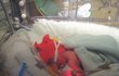 Den porodu Rozárka se narodila v 31. týdnu. Malý drobeček vážil 1145 gramů a měřil 35 centimetrů.