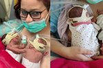 Olinka a Gábinka jsou dvojčátka, která přišla na svět ve 25 týdnu těhotenství.