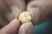 Zubní víla v uniformě: Přerovští strážníci zachránili chlapci (11) zuby z koše