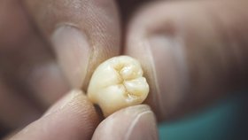 Zubní víla v uniformě: Přerovští strážníci zachránili chlapci (11) zuby z koše.