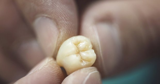 Zubní víla v uniformě: Přerovští strážníci zachránili chlapci (11) zuby z koše.