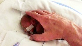 Zázrak: Chlapec vážil po porodu 630 gramů, teď oslavil první narozeniny
