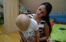 Ellen (4) z Frýdlantu nad Ostravicí: Po hrůze v Bulharsku přišla o vlasy!