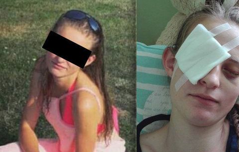 Hasičce Míše (18) se obrátil život naruby: Proud vody ji téměř připravil o zrak! Léčba neexistuje