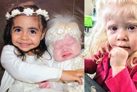 Tohle že je naše dítě? Holčička s albinismem na porodním sále vyděsila maminku!